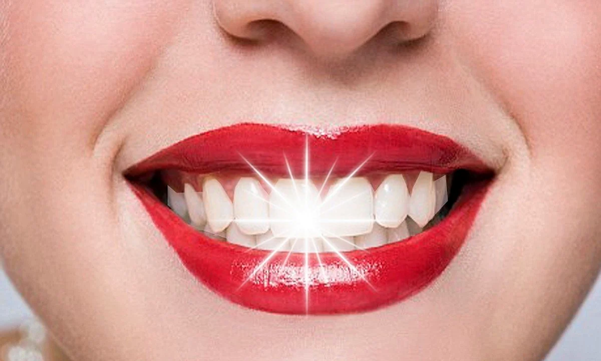 Белые красивые зубы